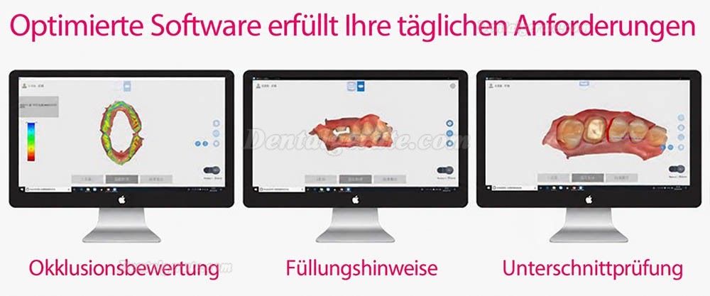 Runyes 3DS Dental 3D Digitaler Intraoralscanner Pulverloses Echtfarbscannen Runyes 3DS Dental 3D Digitaler Intraoralscanner Pulverloses Echtfarbscannen